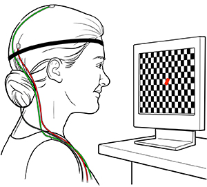 Woman with electrodes on head looking at checkerboard screen during visual evoked potential test.