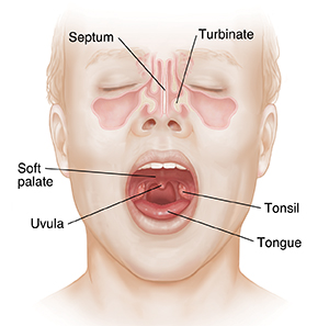 Front view of face showing sinuses and open mouth with tonsils.