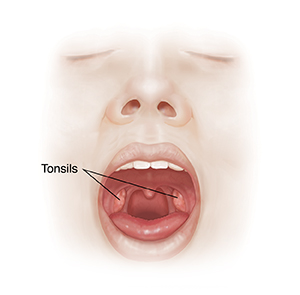 Side view of head showing adenoid and tonsil.