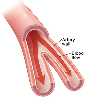 Cross section of artery showing blood flow.