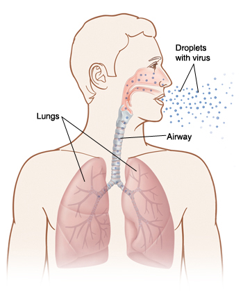 Front view of man's head and chest showing flu droplets being breathed into lungs.