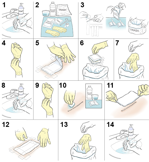 14 steps in changing a surgical wound dressing.