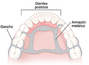 Paladar y dientes, donde puede verse una dentadura parcial.