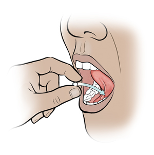 Primer plano de una boca. Se ven dedos que colocan una pastilla debajo de la lengua.