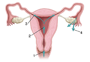 Vista frontal de la sección transversal del aparato reproductivo femenino donde pueden verse flechas que muestran el recorrido a través de la vagina, el cuello uterino, el útero y las trompas de Falopio.