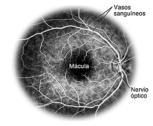 Radiografía de la retina con los vasos sanguíneos resaltados.