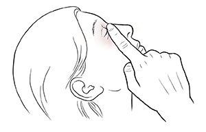 Una mujer con el ojo cerrado después de haberse colocado gotas para los ojos. Se la ve presionando la esquina interna del ojo con su dedo índice.