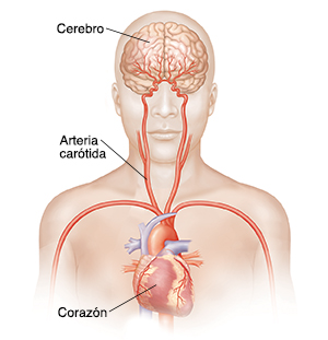 Vista frontal de la cabeza y la parte superior del cuerpo en donde pueden verse las arterias carótidas, el corazón y el cerebro.