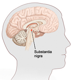 Contorno de una cabeza con corte transversal del cerebro. La sustancia negra es una zona pequeña en la parte inferior central del cerebro.